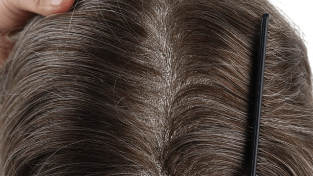 First-Time Hair System Users: What to Expect and How to Adjust